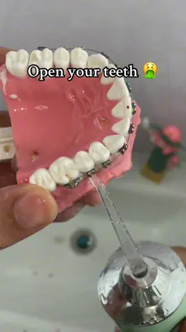 My family and I use it every day #TikTokMadeMeBuyIt #foryou #fyp#teeth #tooth #dentist #teethcleaning #teethwhitening #teethcare #toothache #teethtok #waterflosser #goodthing #homegadgets #homehacks #lifehacks #viral #viralvideo #trend #trending #spotlight #spotlightfinds #TikTokMadeMeBuyIt #TikTokShop #TikTokfinds #tiktokmusthaves #tiktoknews #amazonfinds #amazonmushaves  #us  #FallSweet #shopcider #faiable #GiftGuide #olightup2025 #TTSBeautyBesties #HolidayHaulPawfectPicks #TikTokShopBlackFriday #MadeMyYear #GiftGuide #olightup2025 #TTSBeautyBesties #TikTokShopCreatorPicks #chocolate #christmas #christmasgift #christmascountdown #girl #woman #women 