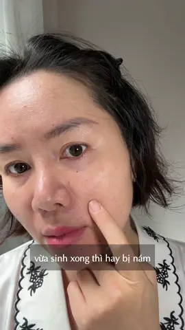 Vừa sinh xong hay bị NÁM sạm đen mà dùng ngay combo NÁM Mocha, thì chỉ có đứng hình mất 3 giây để nhận ra mình. Sản phẩm thông qua chứng chỉ thế giới và bộ y tế cùng các bác sĩ kiểm chứng, nên các bà yên tâm về độ an toàn nha #trinam #goclamdep #duongdanam