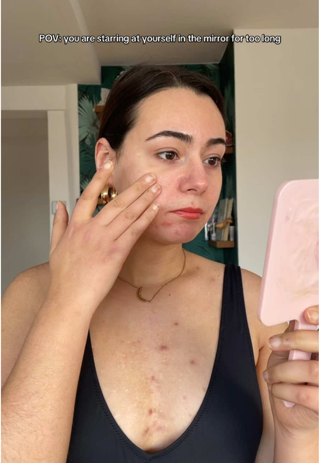 Every time ❤️‍🩹 #acne #skincare #foryou #fypシ #trend #trending #viral 