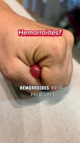 #hemorroides #medicinanatural #hemorroidesexternas #hemorrhoids #hemorroidesinternas 