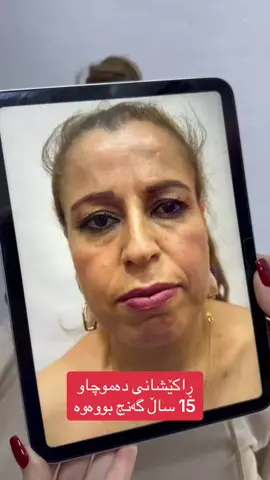 #drhunerbeauty 