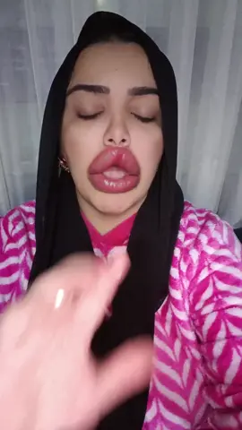 تووحفااا😂😂😂❤️  #فيلر #ام_سجده 