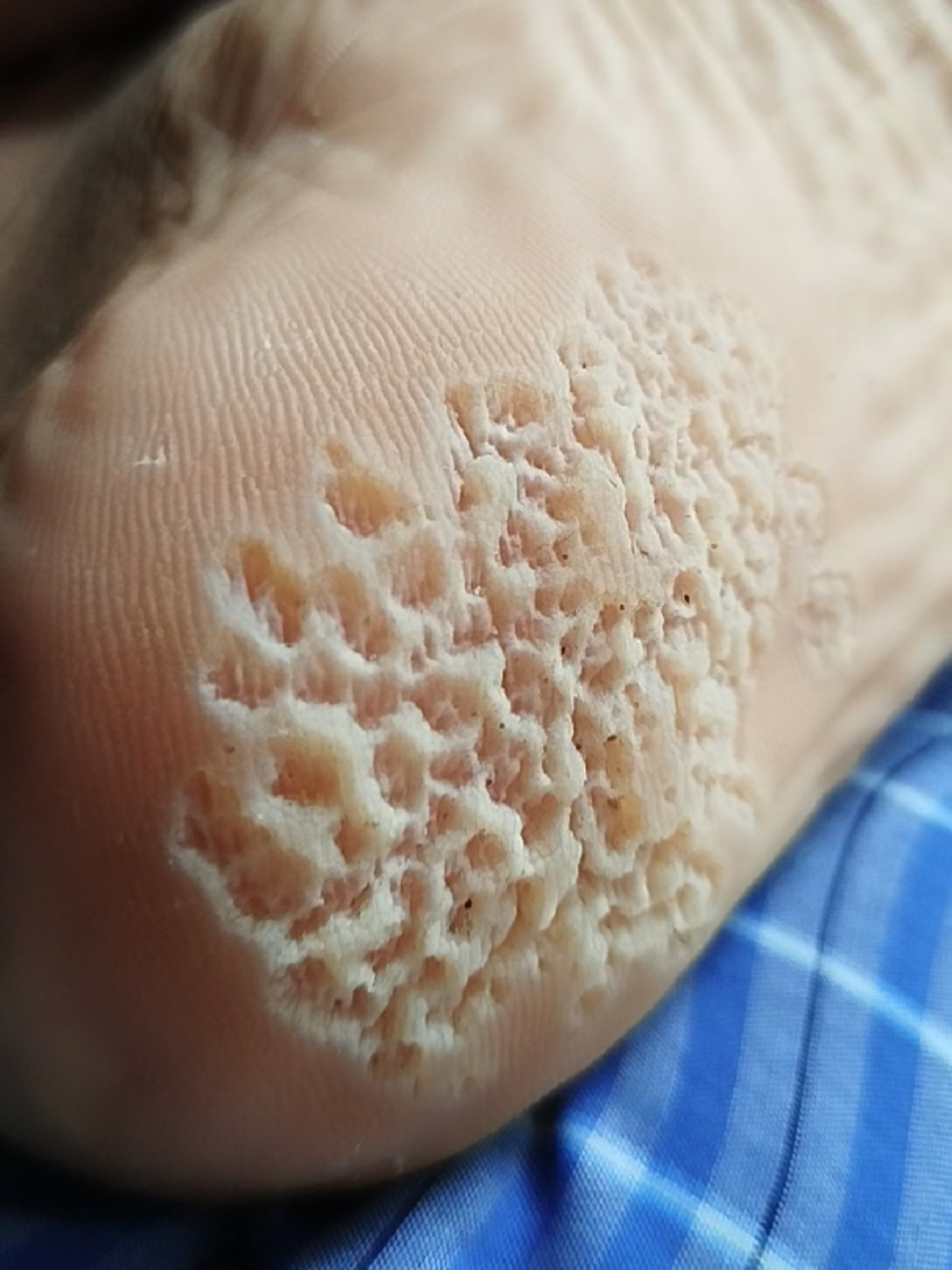 gktau kenapa dh sampe bolong