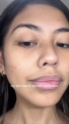 say bye to that heavy feeling! #skintific #skintificph #skincaretok #skintok #5xsunscreen #skincare @SKINTIFICPH 
