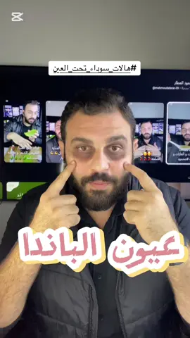 اقوى وصفه في العالم للهالات السوداء #هالات_سوداء #محمود العطار #جمعه_طيبه_بذكر_الله #الجمعة #video #follow #fouryou #foryoupage❤️❤️ #fyb #trendingvideo 