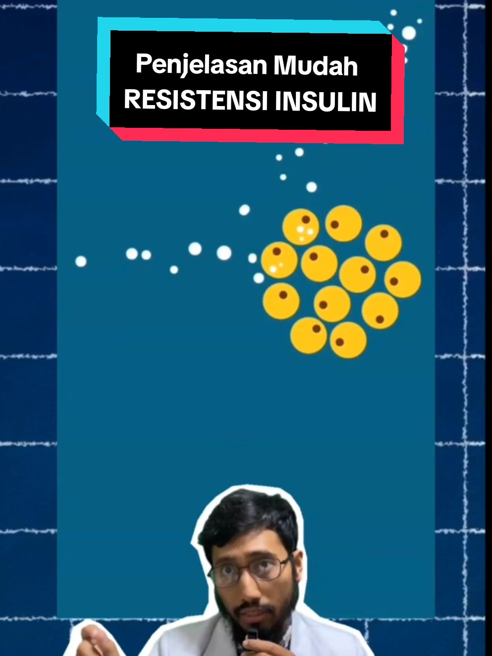 Inilah yang dimaksud RESISTENSI INSULIN #diabetes #diabetesmelitus #guladarah #kencingmanis #resistensiinsulin #insulin #obesitas 