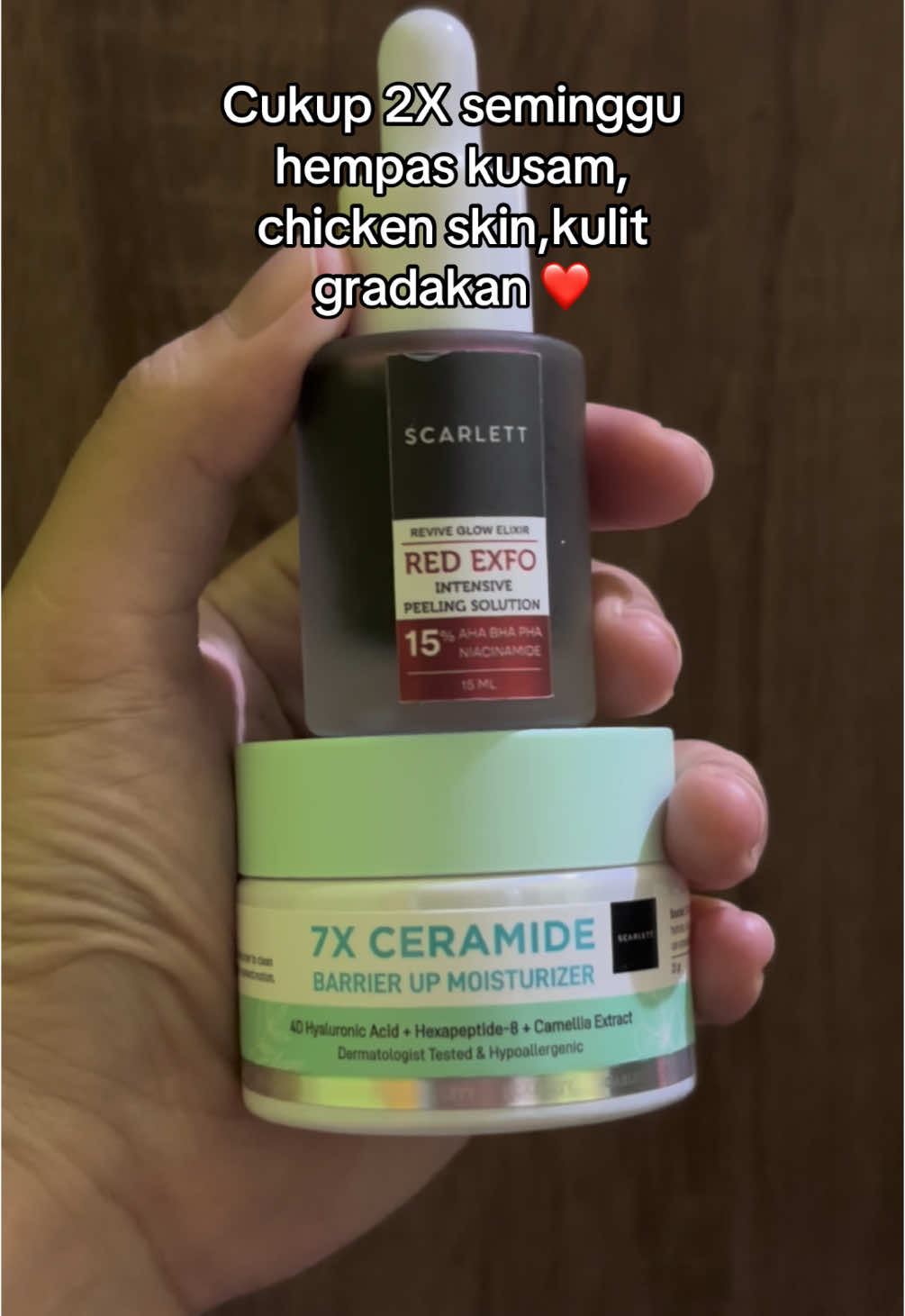 #scarlettredexfo #scarlettwhitening #jagoanvideotrending #cuantanpabatas