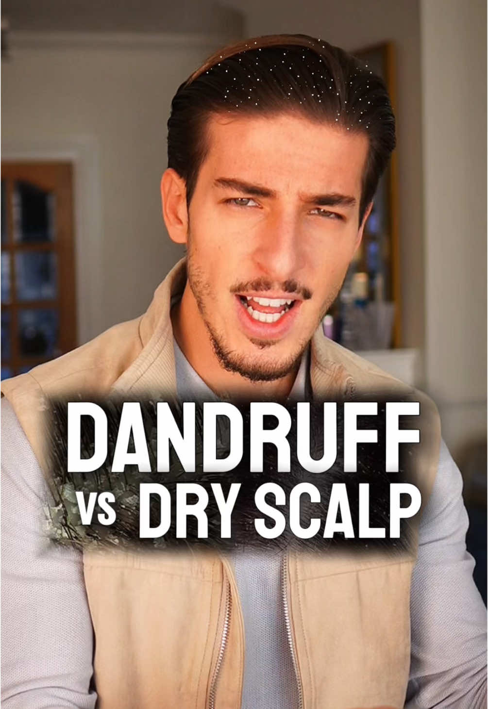 Dandruff vs Dry Scalp - Whats the Difference?🤔 #dandruff #scalpcare #hair #healthyhair #naturalhair #fyppp #soldafades 