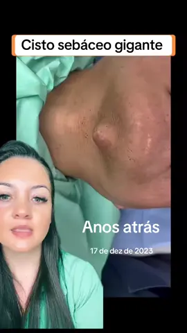 #anosatrás #terapia #cravos #satisfatório #reagindo #limpezasatisfatoria cisto 