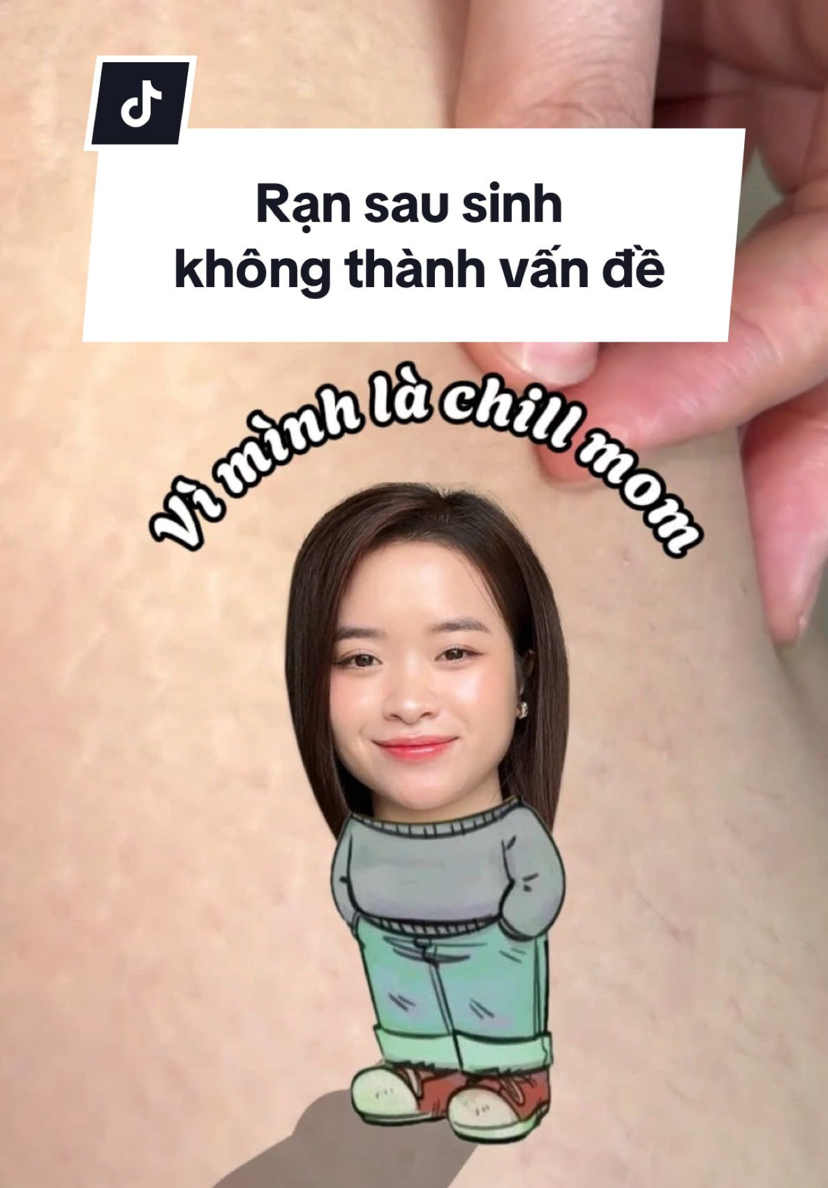 “Chill Mom” không lo rạn da vì đã có Ovela #aberamom #aberamomvietnam #tonvinhphunu #ovelaabera #randa #mebau #mesausinh 