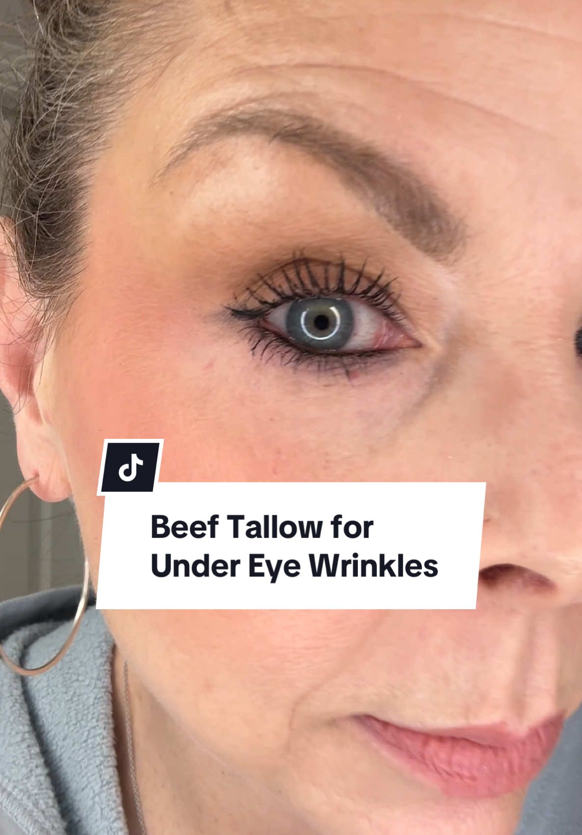 #undereye #beeftallow #hydratedskin @Terra Lotus 