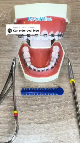 Replying to @Leno  Heres Royal Blue 🦷💙 Comment what color bands youd like to see!  #fyp #orthodontics #dental #braces #viral #dentaloffice #blue #Royalblue #Royalbluebraces #bluebraces 