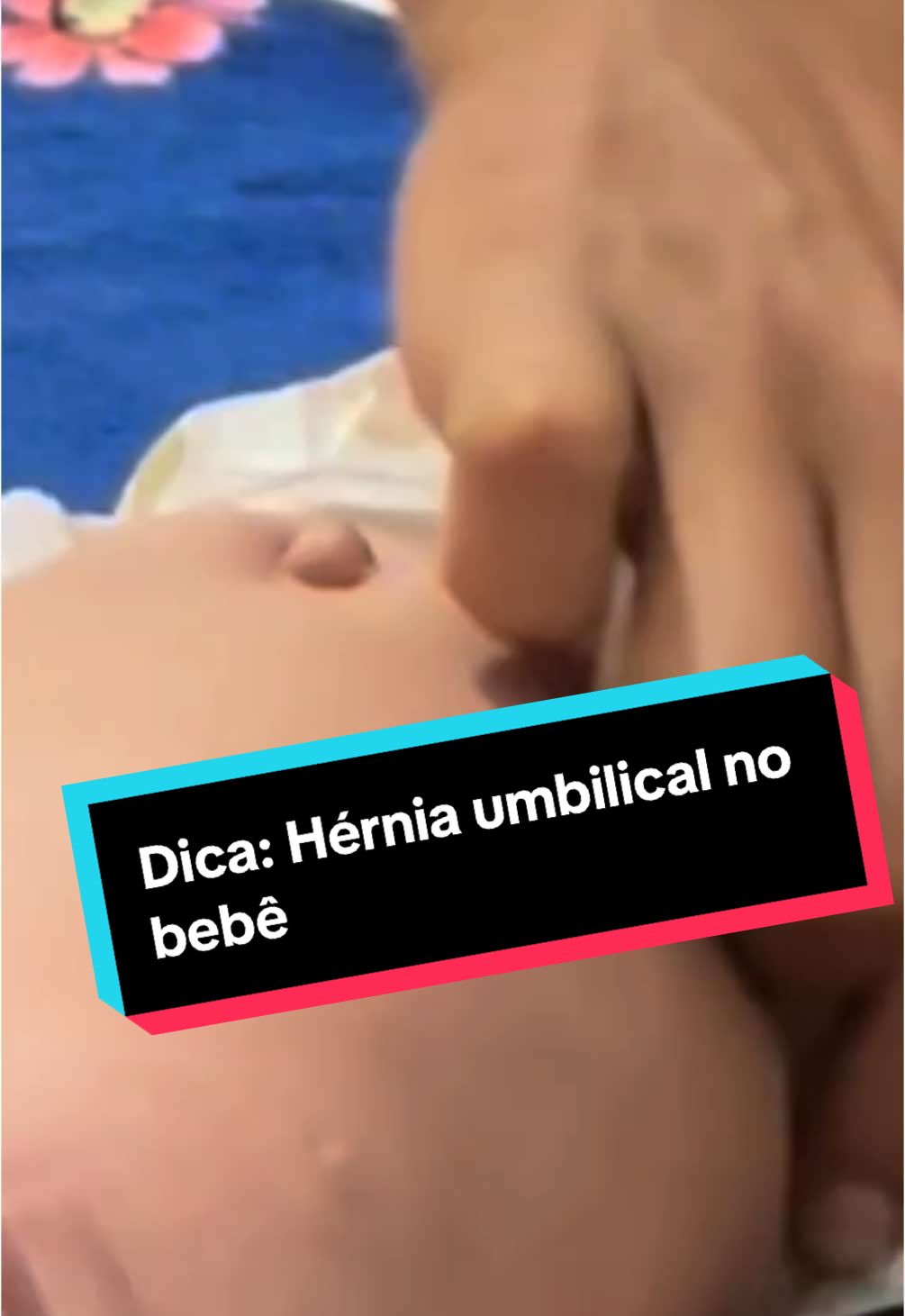Esqueci de falar no vídeo, mas meu médico indicou fazer esse processe durante 6 meses** #dicasdematernidade #maternidade #maternidadereal #dicas #mamae #maes #herniaumbilical #umbigo 