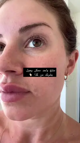 🌟 مرمم لاروش بوزيه: سر البشرة الصحية والمشرقة! 🌟 إذا كنتِ تبحثين عن منتج يعيد لبشرتك الحيوية والترطيب، فإن مرمم لاروش بوزيه هو الحل المثالي. 🔑 المكونات الفعّالة: 💧 البانثينول: يعزز ترطيب البشرة وتهدئتها. 🌿 المياه الحرارية من لاروش بوزيه: تهدئ البشرة وتحميها بفضل خصائصها المضادة للأكسدة. 🧪 ماديسيكاسوسيد: يساعد في تجديد البشرة وتعزيز مرونتها. ✨ الفوائد: 	•	ترطيب عميق للبشرة. 	•	تعزيز لمعان البشرة الطبيعي للحصول على إطلالة صحية. 	•	تهدئة البشرة الحساسة وحمايتها من العوامل الخارجية. امنحي بشرتك العناية التي تستحقها مع لمسة من الفعالية المثبتة! 💧 #لاروش_بوزيه #العناية_بالبشرة #ترطيب_البشرة #مكونات_فعالة #بشرة_صحية 