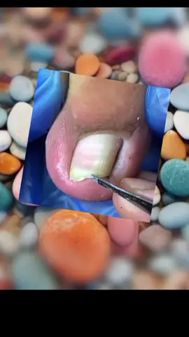 hummm #pedicure #cortes #manicure #unhaencravada #usa_tiktok #limpezadepele 