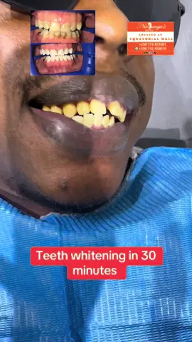 #kampala_uganda🇺🇬🇺🇬🤝 #viral #alienskinug😂🔥🔥 #tattooremoval #florencenampijja 