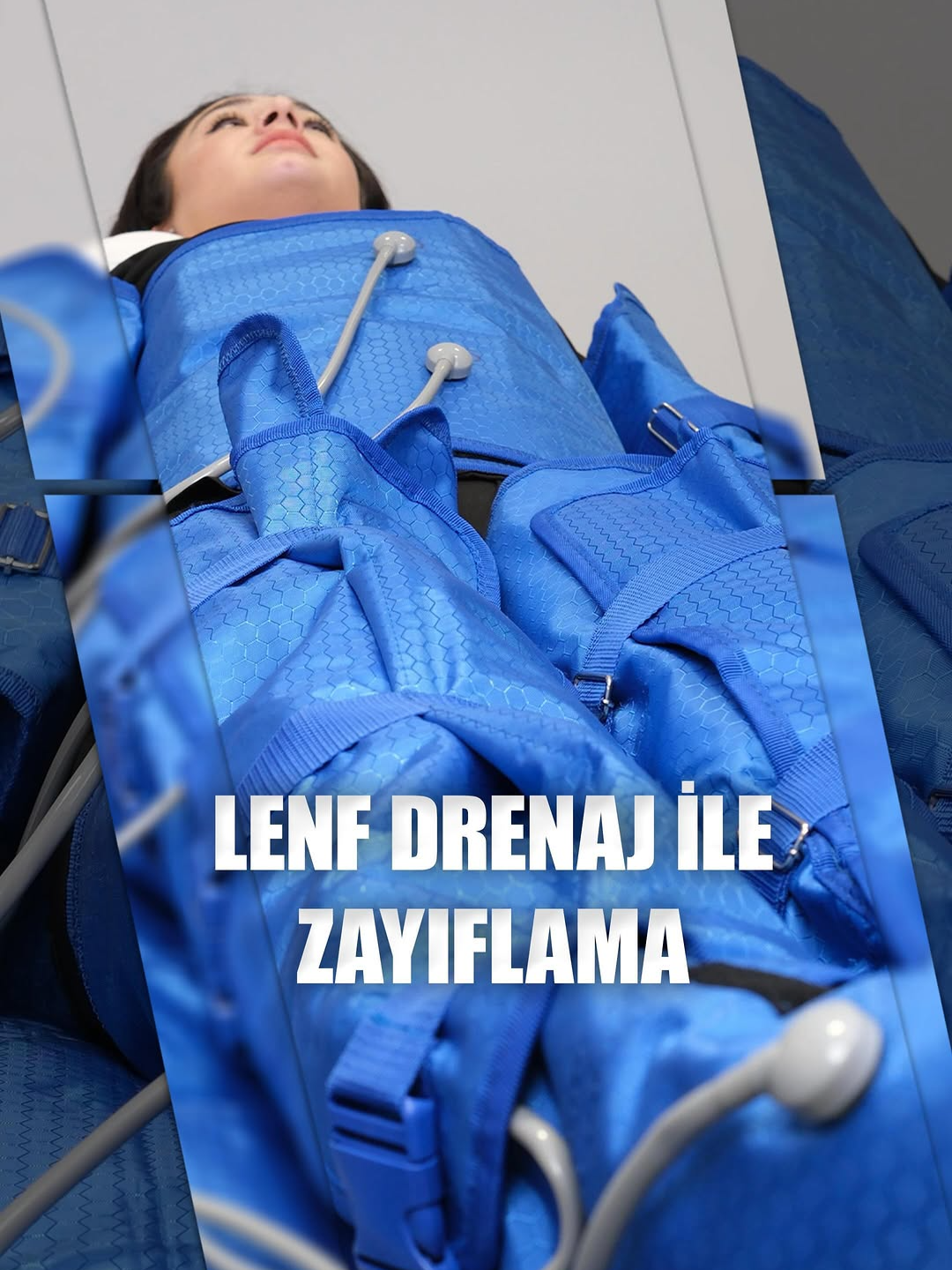 ✨Lenf drenajı, lenf sisteminin vücuttaki fazla sıvıyı toplama, filtreleme ve dolaşıma geri kazandırma sürecidir. Lenf drenajı, lenf düğümleri ve lenf damarları aracılığıyla gerçekleşir. Bu süreç, vücudun bağışıklık sistemi için önemlidir çünkü lenf düğümleri, patojenleri ve diğer zararlı maddeleri filtreleyerek bağışıklık hücrelerinin aktivasyonunu desteklerler. ✨Ayrıca, lenf drenajı, dokularda oluşabilecek ödemleri azaltarak doku sağlığını korur ve vücuttaki dengeli sıvı dolaşımını sağlar. 📌Sayfa içeriği sadece bilgilendirme amaçlıdır tanı ve tedavi için mutlaka hekiminize başvurun. ⚠️Videoların çekilme ve yayınlanma tarihi aynıdır. #lenf #drenaj #zayıflama #selülit #bacak #güzellik #ödem