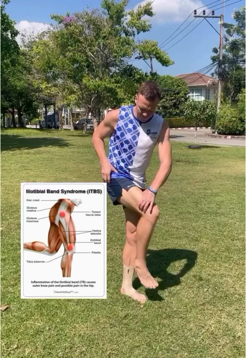 Iliotibial Band Syndrome ITBS - Pulling pain from the outside of the thigh. You need to relax the outer part of your thigh with this stretching exercise and strengthen other muscles using these and additional exercises. When performing single-leg exercises, pay attention to your knee alignment—it should not move inward or outward. #itbssyndrome #itbs #runningtips #runninginjury #runninglife #trailrunner #ultrarunners 
