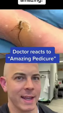 Super Satisfying Pedicure! #wart #callus #dermreacts - #doctor #react #skincare #squeezeyuk #acne #pimple #pimplepop #blackhead #satisfying #foryoupage #foryou  #تنظيف_بشره  #whiteheads #رؤوس_سوداء #عنايه_بالبشره #دهون 