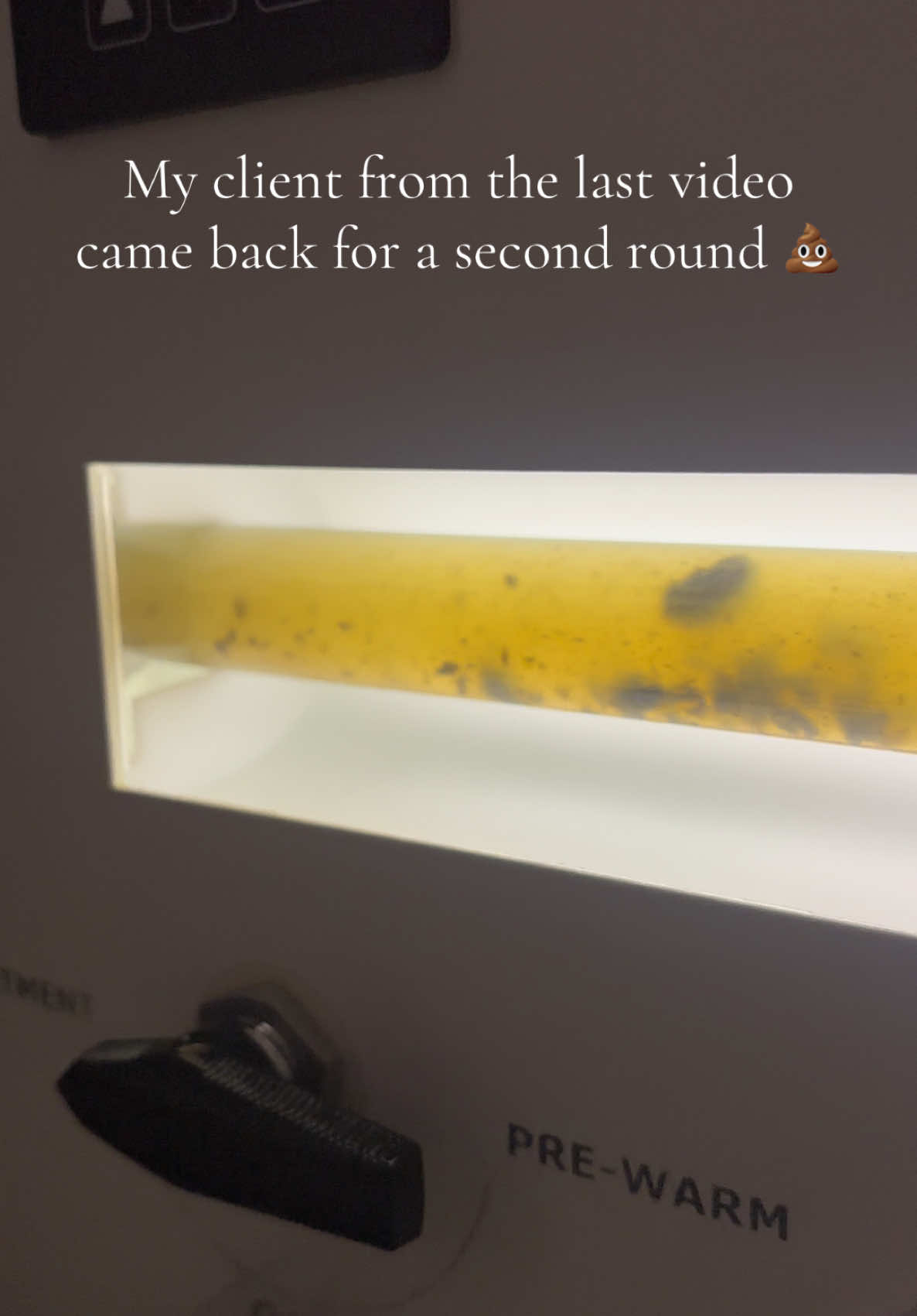 Round 2 of 3 💩 #parasitecleanse #colonic #colonhydrotherapy #guthealth #guttok #stomachproblems #ibs #constipation #colon #guthealthmatters #inspirecht #colonhydrotherapist #gut #clt 