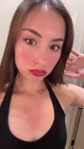 sunburn and drunk glow
