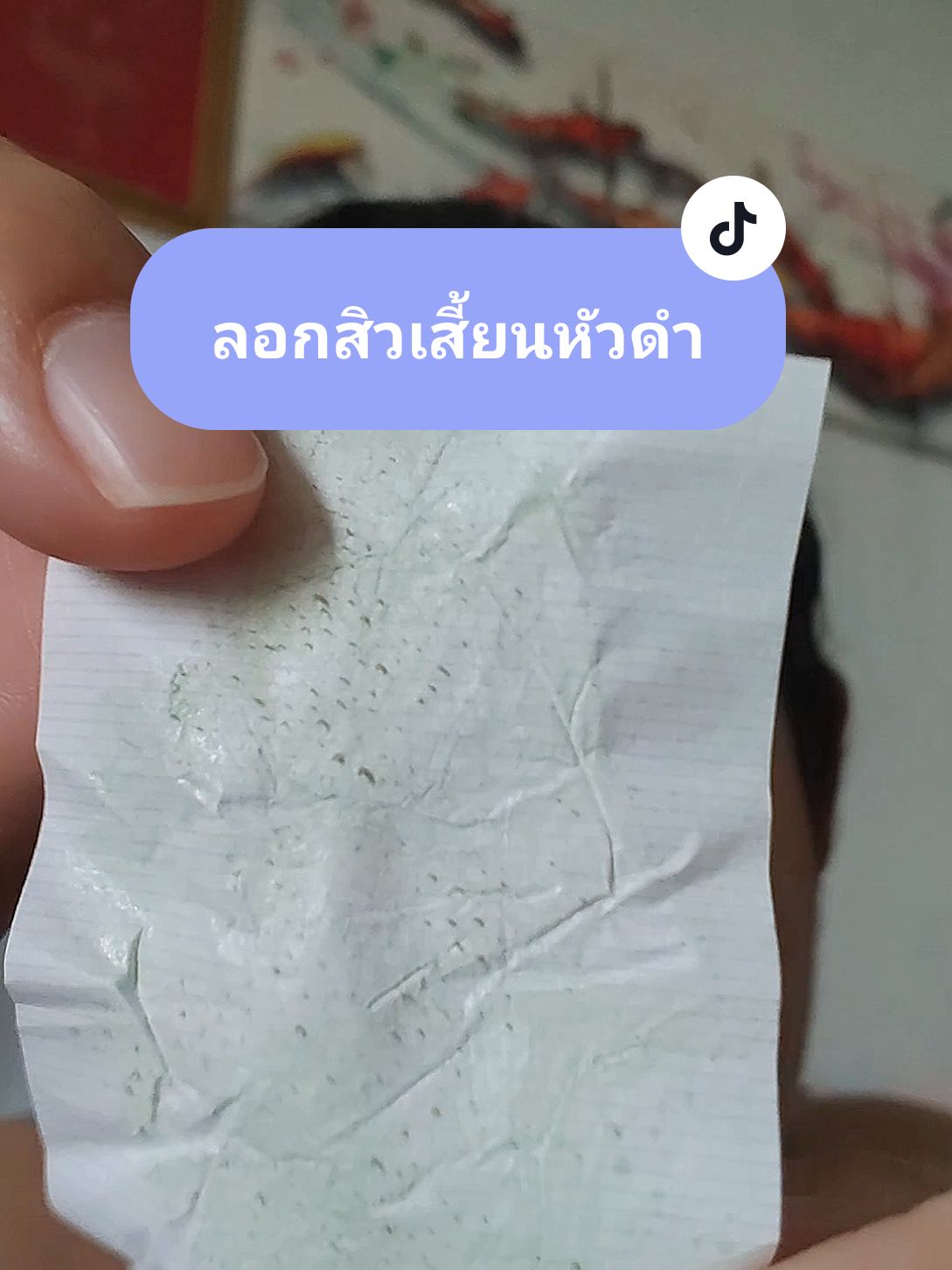 แผ่นลอกสิวเสี้ยน #ลอกสิวเสี้ยน #แผ่นลอกสิวเสี่ยน #แผ่นลอกสิว #เค้กที่หมายถึงขนม  @เค้กที่หมายถึงขนม @เค้กที่หมายถึงขนม @เค้กที่หมายถึงขนม 