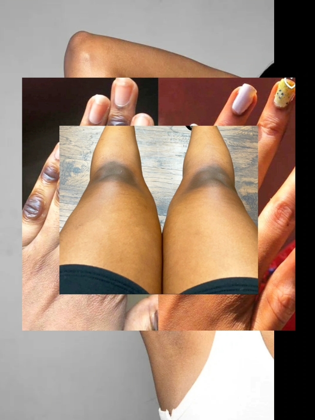 Replying to @enate437  Home remedies for dark spots on skin  #SelfCare #skincare  #ethiopian_tik_tok  #habeshatiktok #girls  #girlyzoneethiopia 