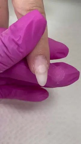 Bolha e infiltração  #infiltracaounha #descolamentounhas #manicurecombinada