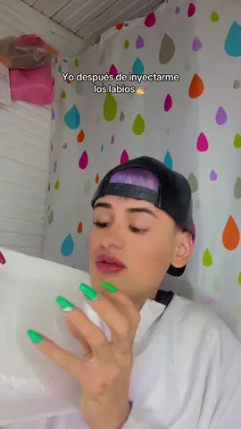 Yo despues de inyectarme los labios 💅  #LIVEhighlights #TikTokLIVE #LIVE #venezolanosenchile🇻🇪🇨🇱 