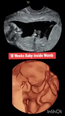 18 weeks Baby inside Womb during ultrasound #babyultrasoundpost✨ #babyultrasoundscan #pregnancyultrasound #viraltiktok #viralvideo #babyultrasound #pregnanttiktok #pregnantlife #pregnancyjourney #18weekspregnant #18weekstoday 