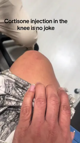 This was my second time receiving a cortisone injection in my left knee and althoigh he numbs the area first, the pressure I feel on the inside is no joke 😂 it only lasted a second though #fyp #viral #cortisoneinjection 