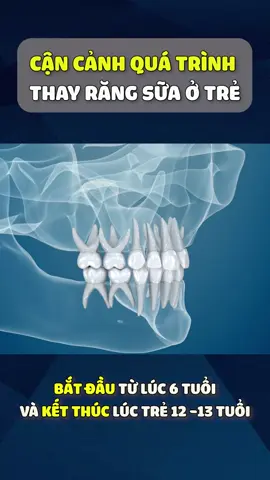Cận cảnh quá trình thay răng sữa của trẻ #mocrang #mocrangkhongsot #nhakhoa #nhakhoanucuoiduyenbinhduong #xuhuong #LearnOnTikTok