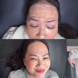 Loại bỏ sự già nua, để lại chiếc nhan sắc tươi trẻ 😆
