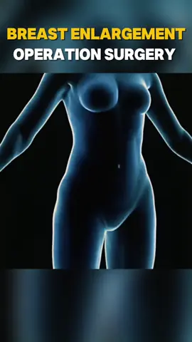 Discover the Science Behind Breast Augmentation: A 3D Surgical Journey! #BreastAugmentation #3DAnimation #MedicalEducation #SurgicalProcedure #HealthAwareness #BodyTransformation #MedicalAnimation #PatientEducation #WellnessJourney #HealthcareInnovation