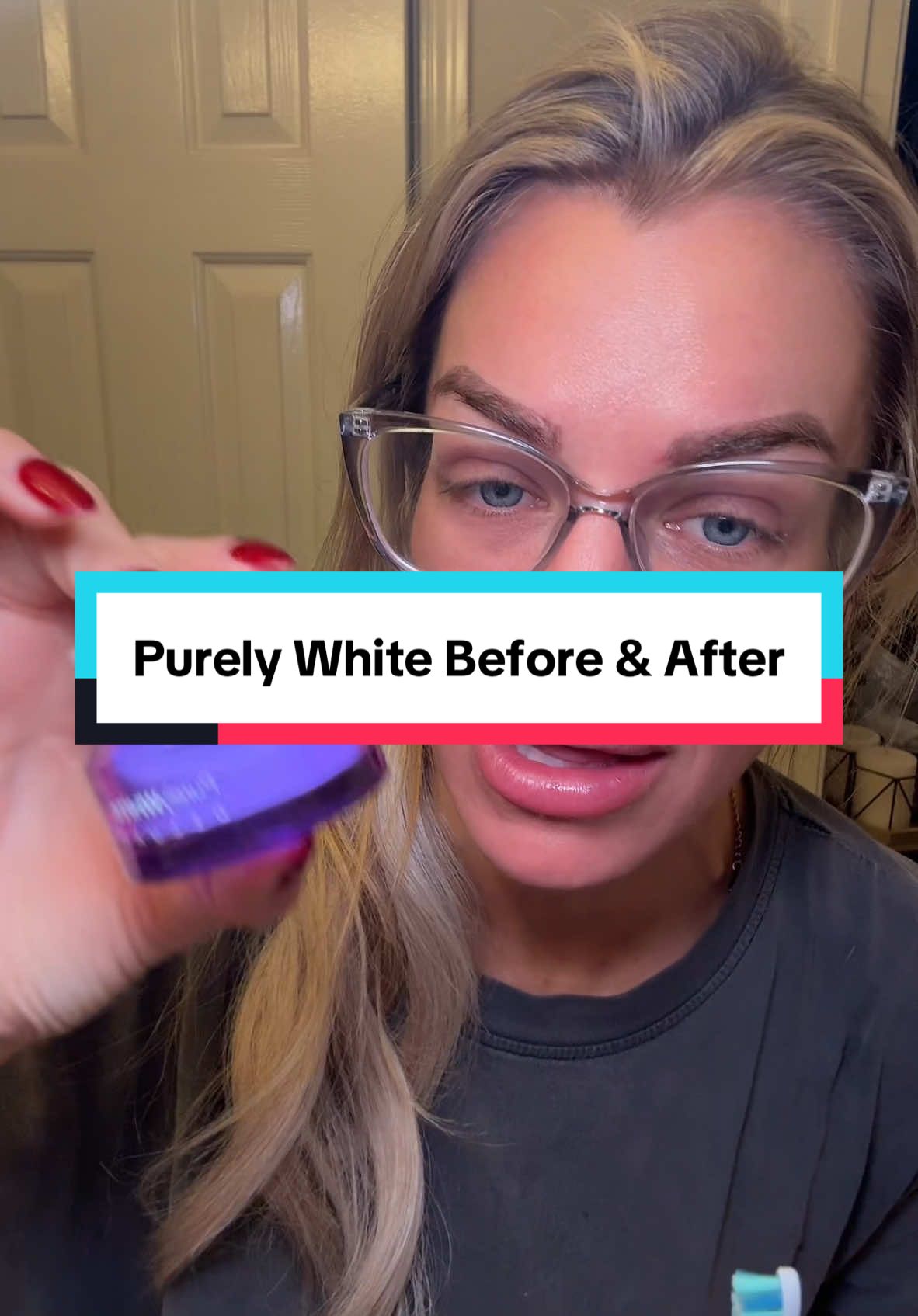 Purely white before and after!! I’m obsessed with how this instantly whitens my teeth!! It’s so good! #teethtok #teethwhiteningkit #teethwhiteningstrips #whiteteeth #purelywhitedeluxe 