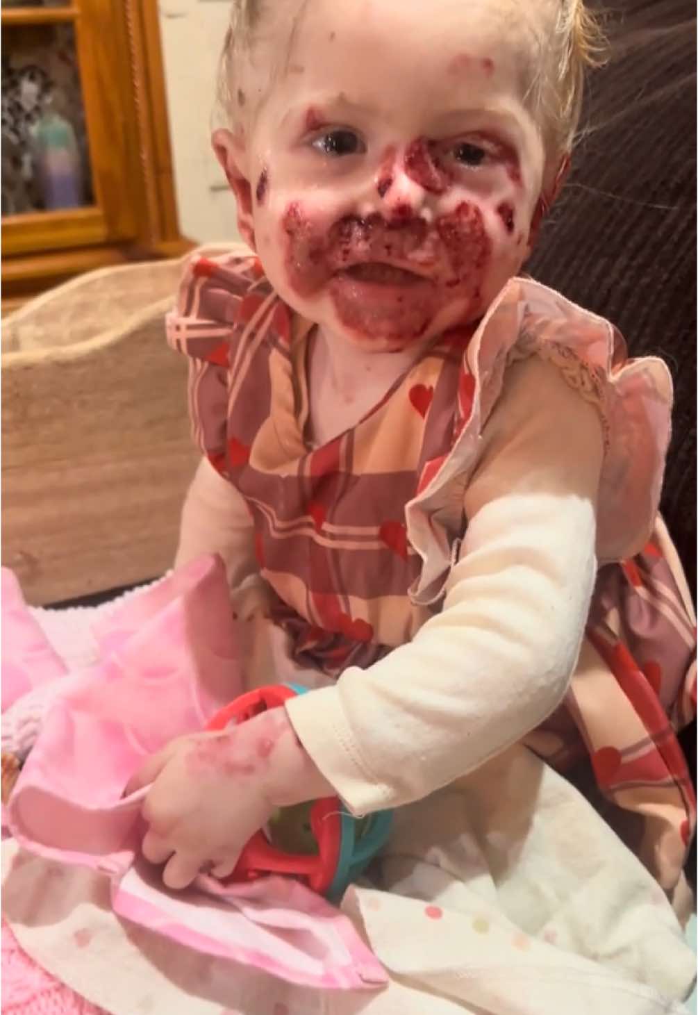 Tova says Merry Christmas to everyone! Tova has a rare skin disease called junctional EB, she has super fragile skin like butterfly wings, unfortunately there is no cure for this disease. Please follow Tova on her beautiful journey of life with us! #junctionalepidermolysisbullosa #family #awareness #ebawarness #findacure #findacureeb #butterflychild #skindisease #epidermolysisbullosa #FYP #fypシ゚viral🖤tiktok #saskatchewan #beautifulday #beautiful #christmas #christmas2024 