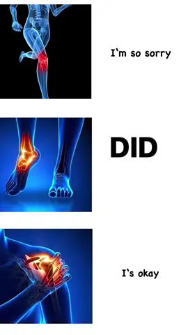 #tornligament #pain #ihateit #anklejoint 