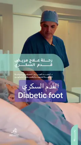 القدم السكري Diabetic foot #diabetic #vascular #kuwait 