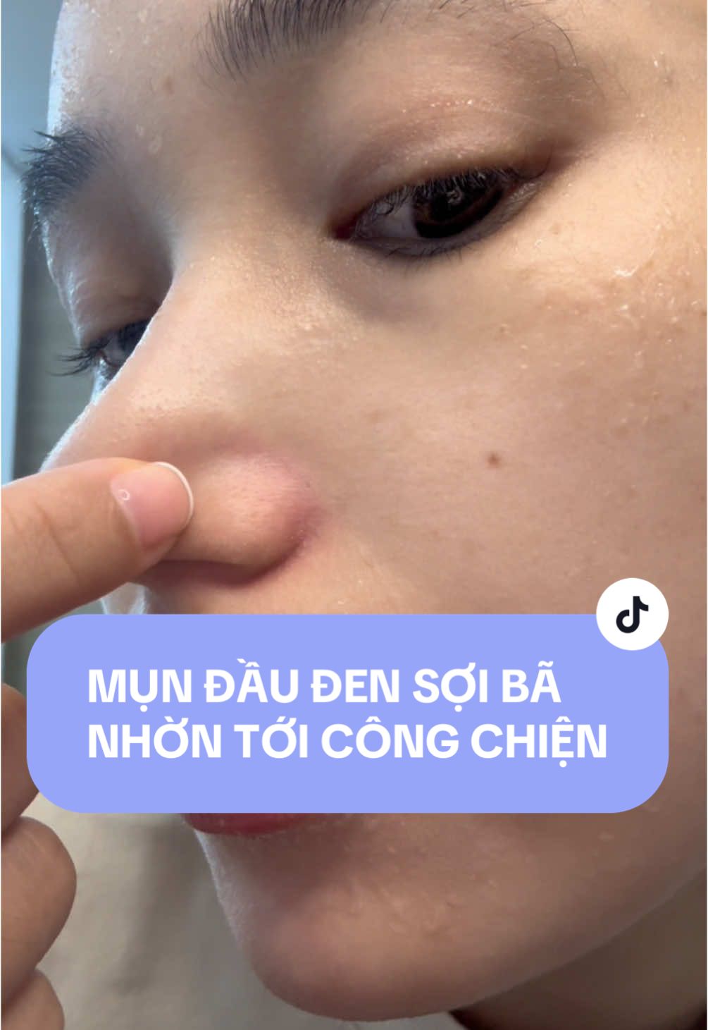 Làm 1 phát cả họ nhà bã nhờn da đê #ilsovn #ilso #umunilso #lochanlong #skincare #skincareroutine #skincaretips 