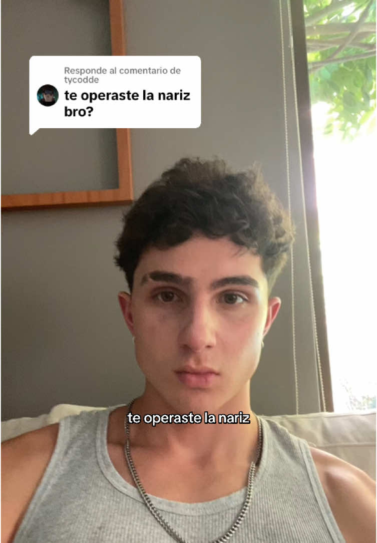 Respuesta a @tycodde Me operé la nariz? #chile #nariz  