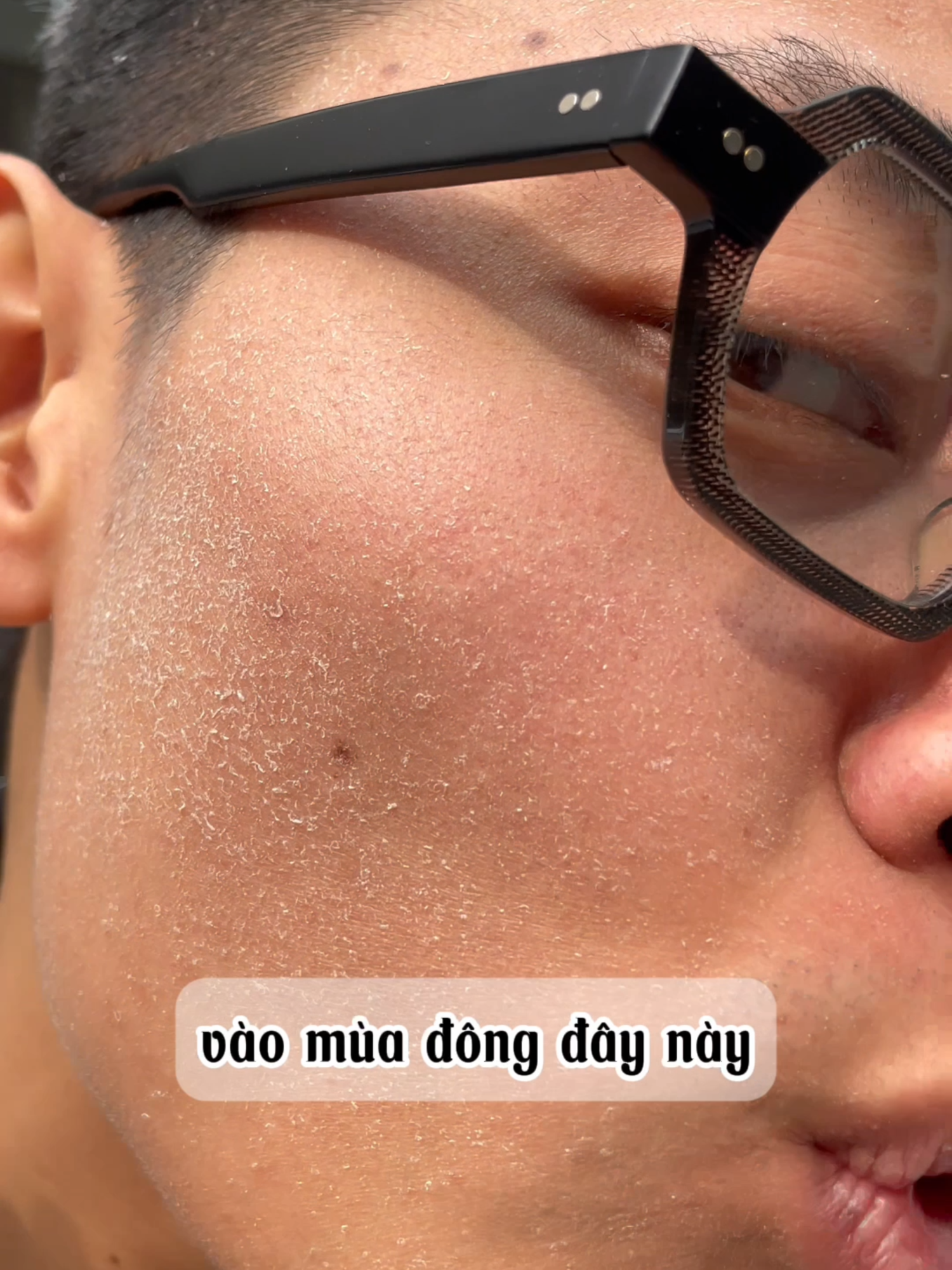 Sữa rửa mặt cấp ẩm cho làn da khô, nứt nẻ #Nerman #suaruamat #srmnamgioi #srm #xuhuong