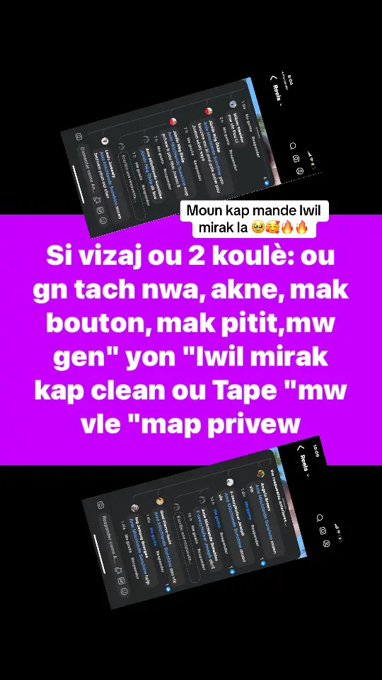 Si vizai ou 2 koule: ou gn tach nwa, akne, mak bouton, mak pitit, mw gen