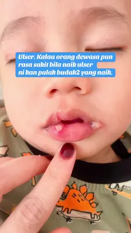 Mommy ada pengalaman tak, anak naik ulser dekat bibir dan mulut ? Apa tips mommy.  #fypシ゚viral #ulsermulut #ulserbibir #anaknaikulser #anakbijakpandai❤️ 