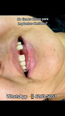 #puravida🇨🇷 #citas #odontologia #costarica🇨🇷 #costarica #clinicadental #ticos #ticos🇨🇷 #estética #ElMejorPrecio #tiktokticos #ticospuravida #dientesperfectos #puravida🇨🇷 #puravida 