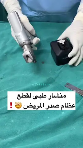المنشار الطبي الكهربائي هو أداة أساسية في جراحة العظام، يستخدمها الأطباء لقص العظام بدقة وسرعة، مما يجعل العمليات أكثر كفاءة وأقل خطورة.  صُمم بتكنولوجيا متطورة تجمع بين المحركات الدقيقة والتصميم المريح، ليمنح الأطباء تحكمًا كاملاً أثناء العمليات.  بفضل هذه التكنولوجيا، أصبح بالإمكان تقليل مدة الجراحة وتحسين دقة العمل، مما يساعد المرضى على التعافي بسرعة ونتائج أفضل.  إنه مثال رائع على كيف تُحدث التكنولوجيا الطبية فرقًا كبيرًا في حياة المرضى والجراحين. - - - - - - - - - - ‎لمتابعة أحدث الابتكارات والمعلومات في التكنولوجيا الطبية الحديثة، تأكد من متابعتنا✅ ‎م. عباس حازم ‎‏@3bas.x1  - - - - - - - - - - منصة الهندسة الطبية  الهندسة الطبية #طب #مستشفى #جراحة #صحة #اكسبلور #medical 