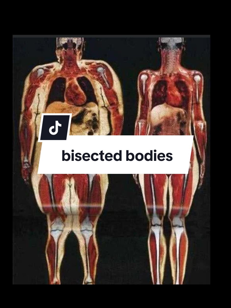 interesting #body #bodyscan #healthy #overweight #comparison #bisected #fatstorage #humanity #anatomy 