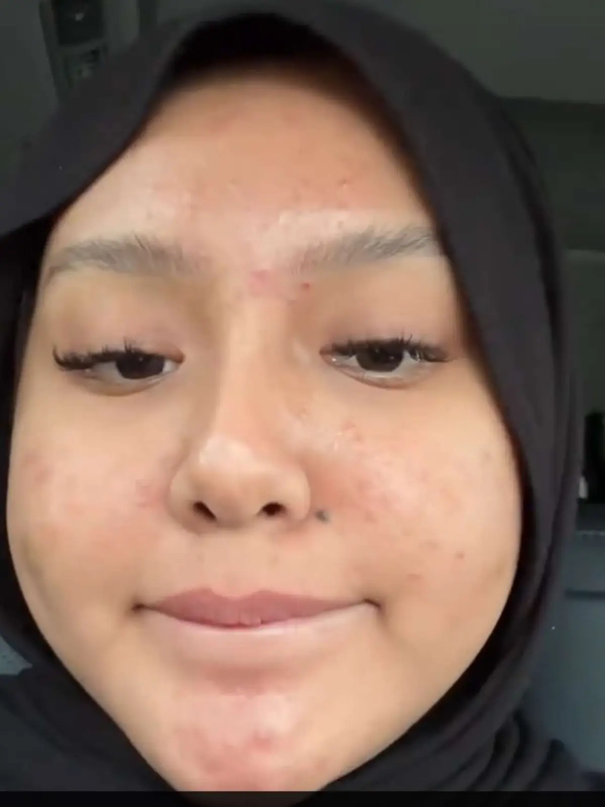 Tak senang tapi syukur , lepas 3 bulan hamil start boleh minum terus skin improve better . Sy consume sendiri tau sumpahhh🥺 sapa share feedback jugak yuni belanja duit tau