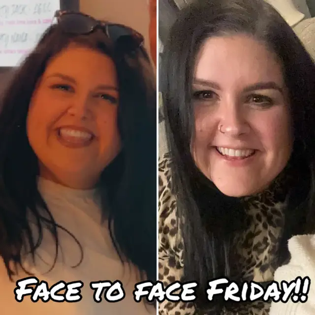 Only ever look back, to see how far you’ve come ♥️ #facetoface #mounjaro #mounjarojourney #mounjaroweightloss #glp1 #caloriedeficit #nsv