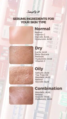 📌Save & Share, Find the Perfect Serum ingredients for Your Skin Type!✨  Not all serums are created equal, and your skin deserves the best! Here’s how to match your serum to your skin type:  🌿Normal Skin: -Balance and maintain that healthy glow effortlessly. 💧Dry Skin: -Deeply hydrate and lock in moisture for supple skin. ✨Combination Skin: -Target oily zones and nourish dry areas for harmony. 🌟Oily Skin: -Control excess shine while keeping your skin hydrated. #simplyu #kbeauty #fyp #brunei