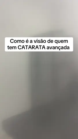 A catarata é uma doença que deixa o cristalino do olho opaco, prejudicando a visão. Ela é comum em pessoas idosas, mas pode ocorrer em qualquer idade, impedindo que as atividades cotidianas sejam realizadas e progredindo rapidamente, até causar cegueira.  A catarata deixa o cristalino opaco, impedindo que a luz passe corretamente. Basicamente, a nitidez das imagens fica prejudicada e tudo começa ficar esbranquiçado, amarelado, turvo ou embaçado. #catarata #cataratas #olho #visao #oftalmologia #otica #visao #saude #oculos #oculosdegrau 
